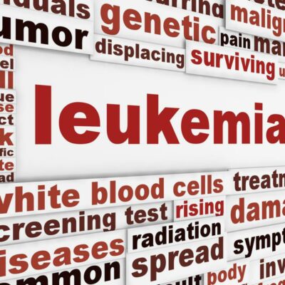 Diagnosis and Treatment Methods for Leukemia