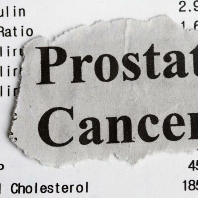 Understanding The Top Risk Factors For Prostate Cancer