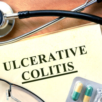 Natural Treatments For Ulcerative Colitis