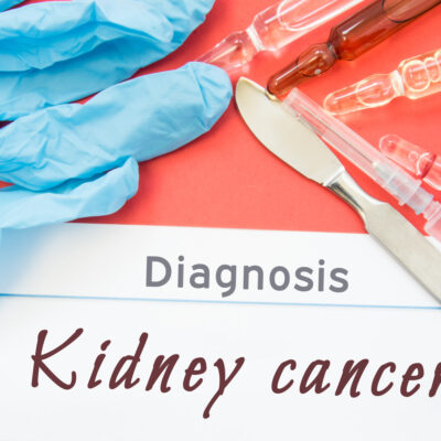 Know About The Process Of Diagnosing Kidney Cancer