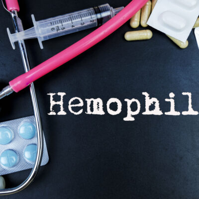 The Process Of Diagnosing And Treating Hemophilia