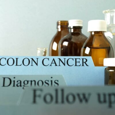 Know All About The Different Stages Of Colon Cancer