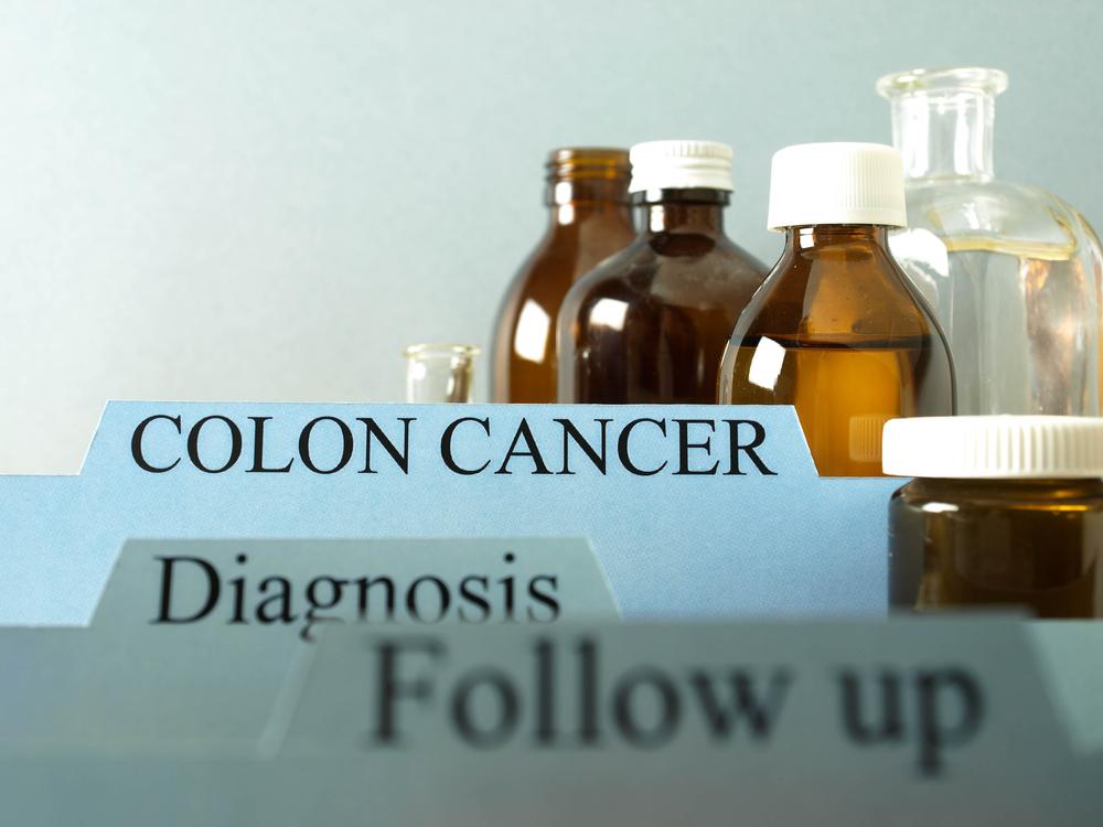 Treatments For The Main Stages Of Colon Cancer