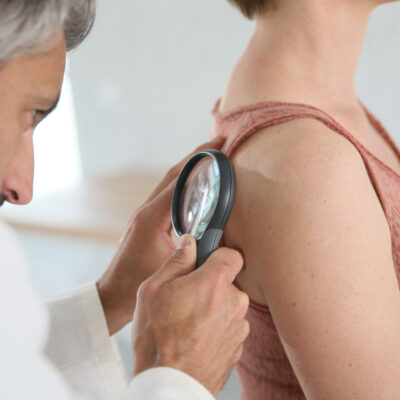 Learn More About The Symptoms And Causes Of Melanoma