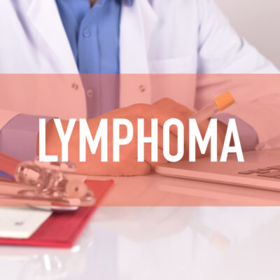 An Overview of the Different Types of B-cell lymphoma