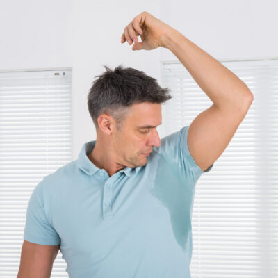 Treatments for Hyperhidrosis