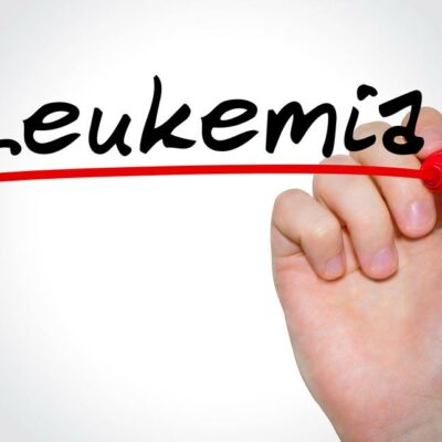 Philadelphia Chromosome–Positive Chronic Myeloid Leukemia (Ph+ CML)