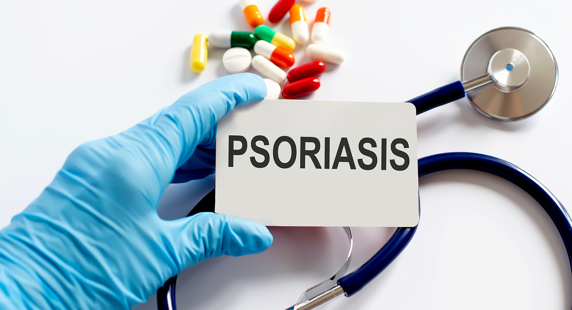 5 Major Causes Of Psoriasis Revealed